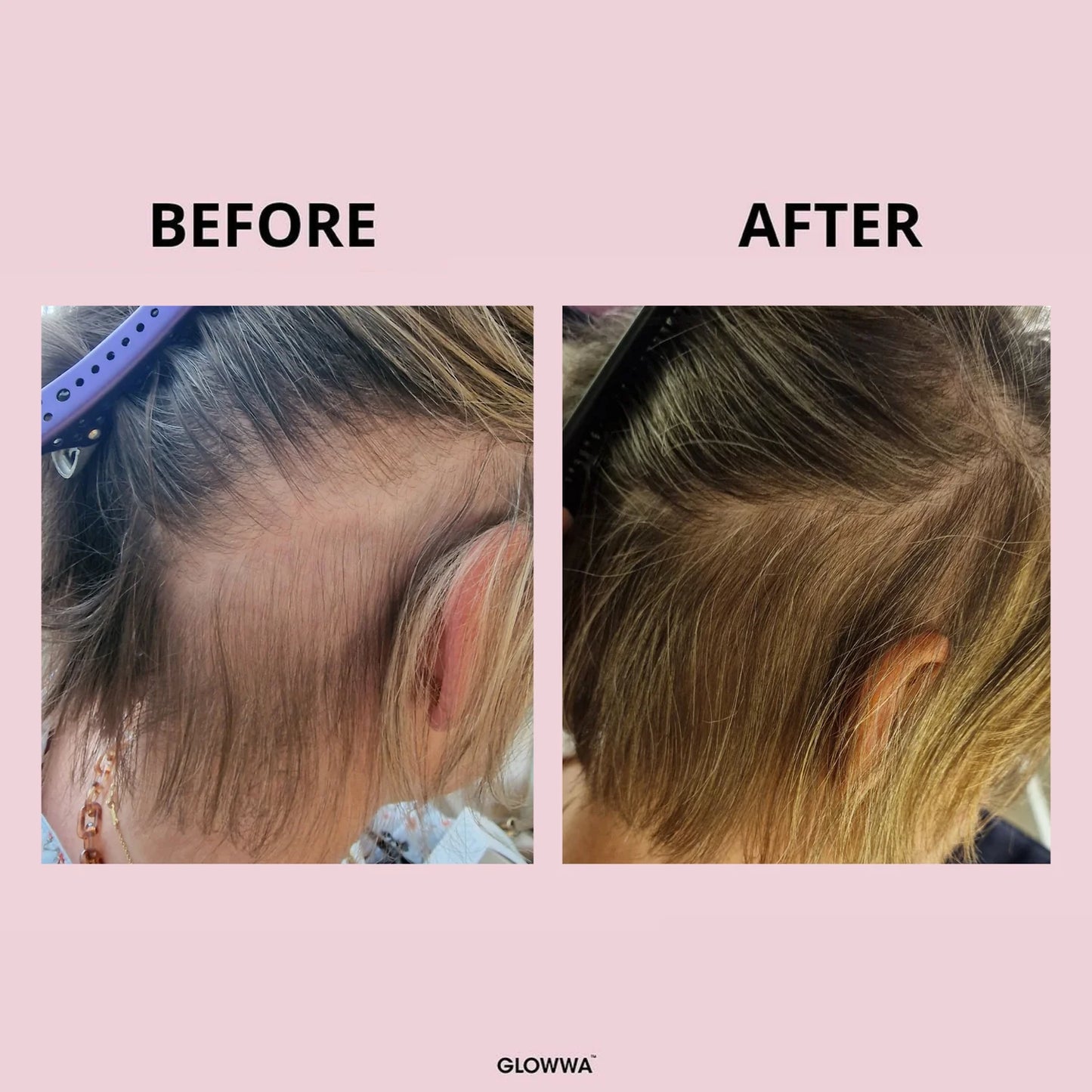 GLOWWA Hair Food