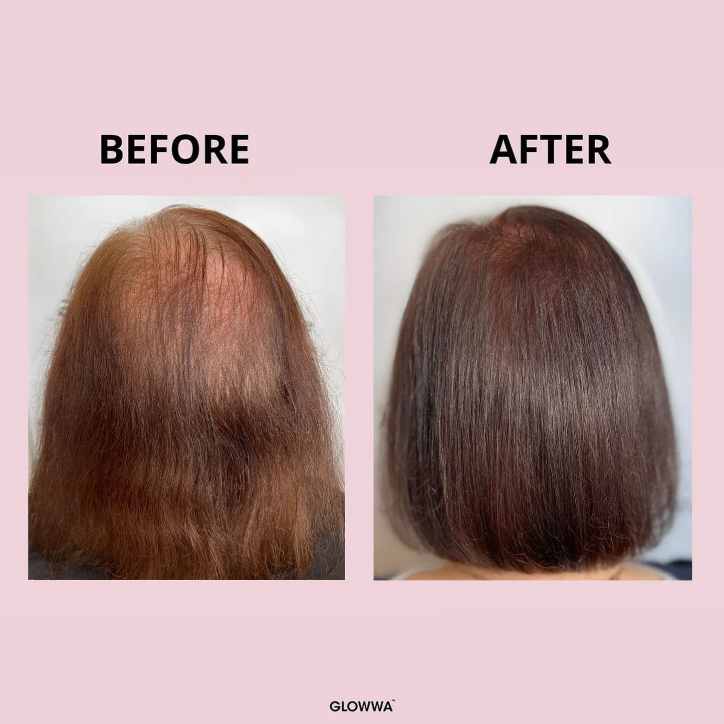 GLOWWA Hair Food