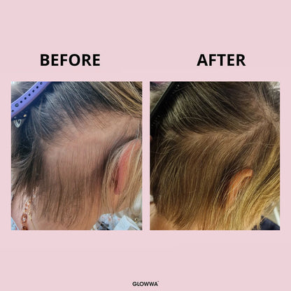 GLOWWA Hair Food